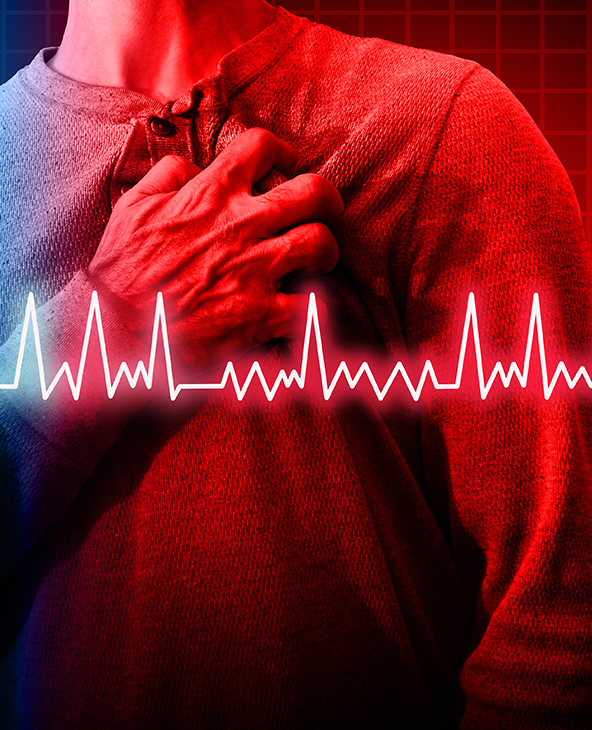 Arrhythmia Treatment in Dehradun