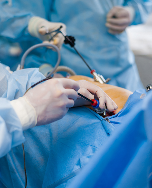 Cholecystectomy (Gallbladder Removal Surgery) in Dehradun