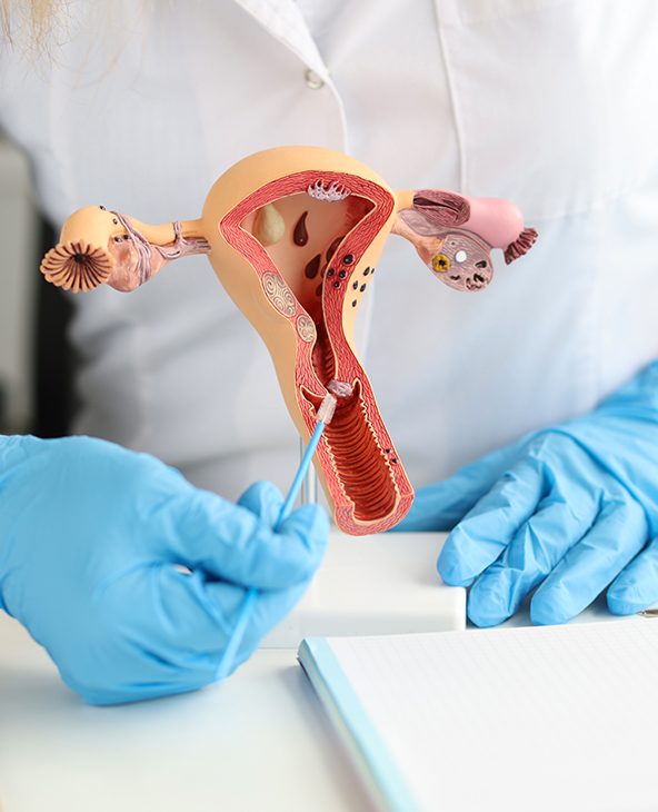 Hysterectomy (Uterus Removal Surgery) in Dehradun