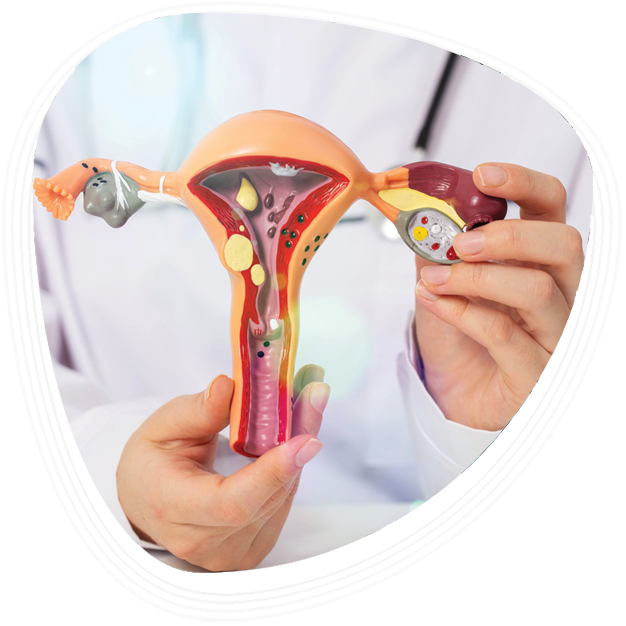 Why Choose Graphic Era Hospital for Ovarian Cyst Treatment?
