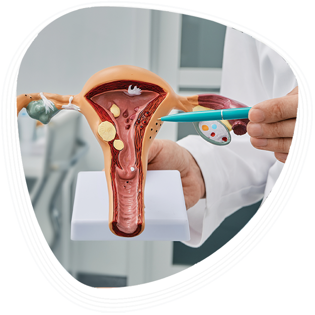 Why Choose Graphic Era Hospital for Vaginal Cyst Treatment