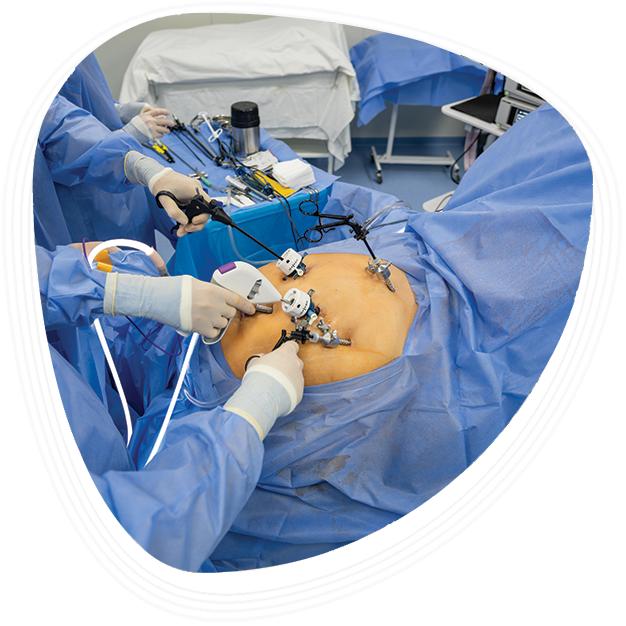 Why Choose Graphic Era Hospital for Minimally Invasive Surgery?