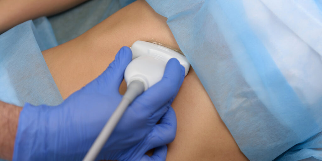Fibroscan vs ultrasound