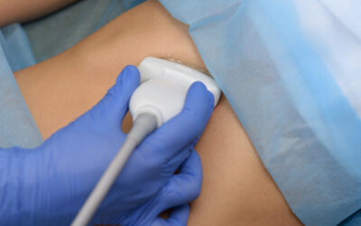 Fibroscan vs ultrasound