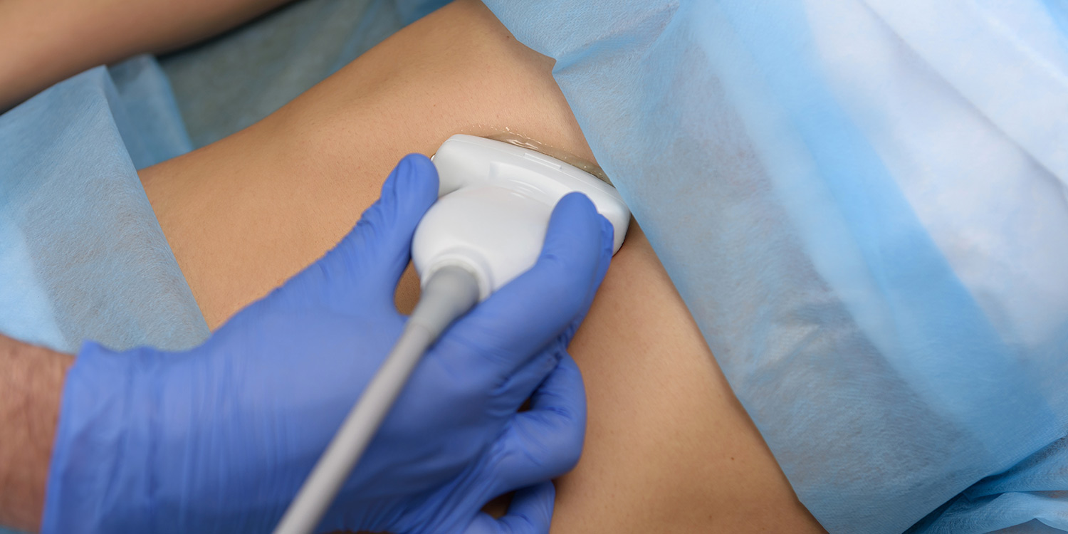 FibroScan vs. Ultrasound: What’s the Difference?