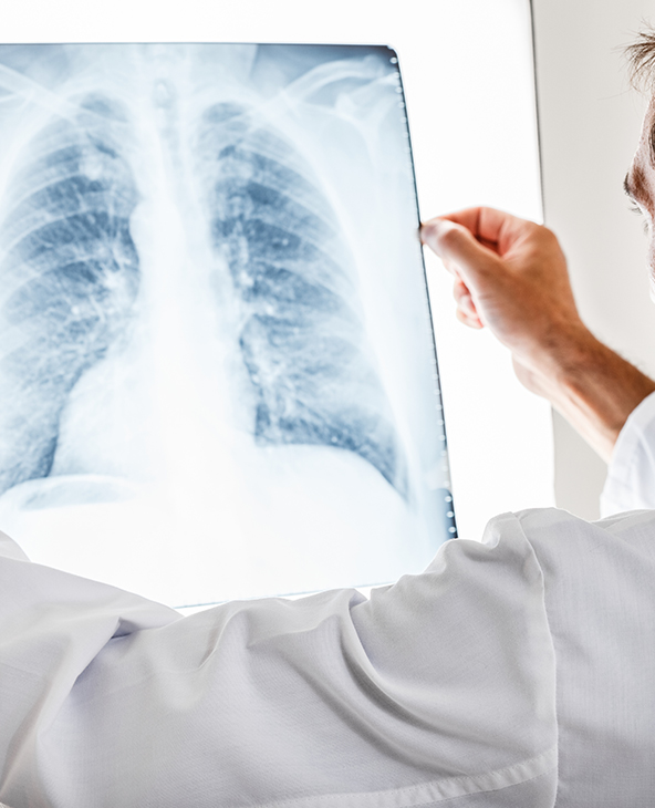 Pneumonia Treatment in Dehradun