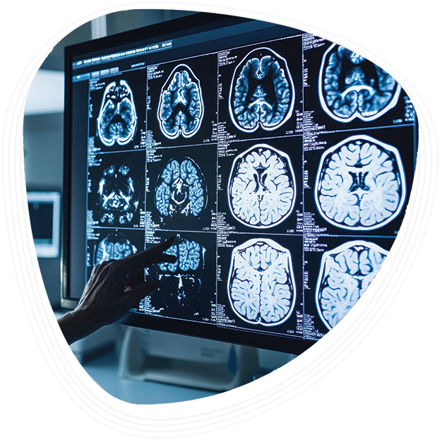 Why Choose Graphic Era Hospital for Brain Tumor Surgery
