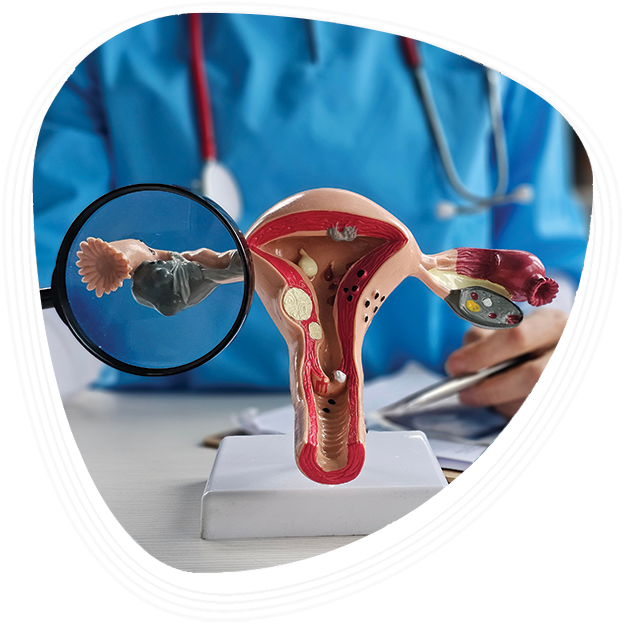 Why Choose Graphic Era Hospital for PCOS Treatment
