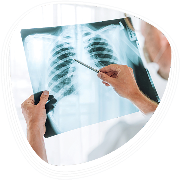 Why Choose Graphic Era Hospital for Pneumonia Treatment