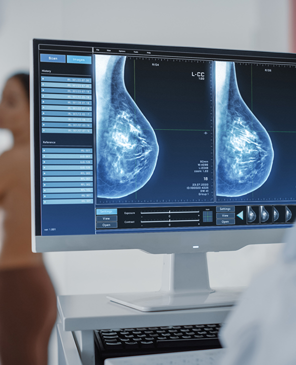 Breast Cancer Treatment in Dehradun