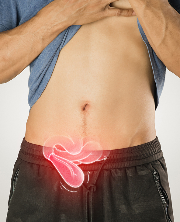 Hernia Treatment in Dehradun