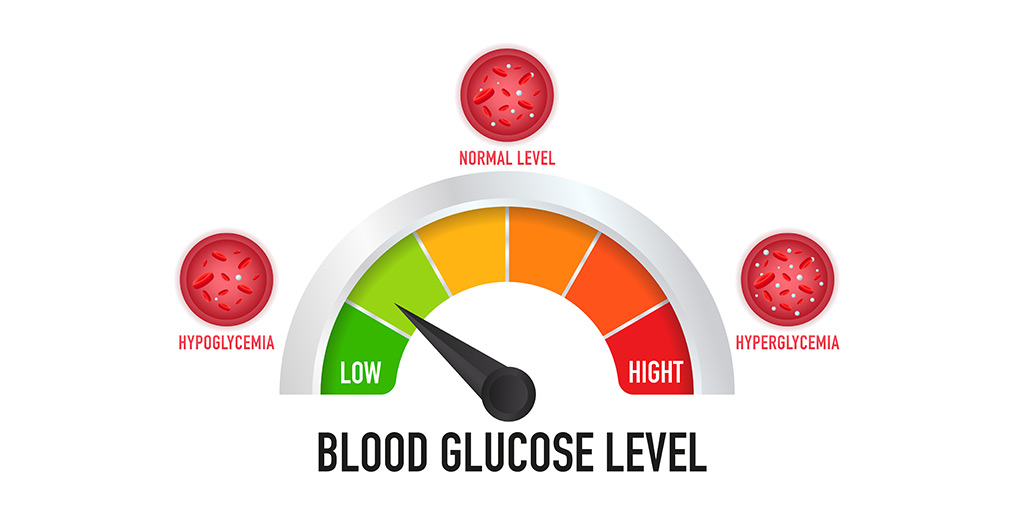 Hypoglycemia in Diabetes: Causes, Risks, and Prevention
