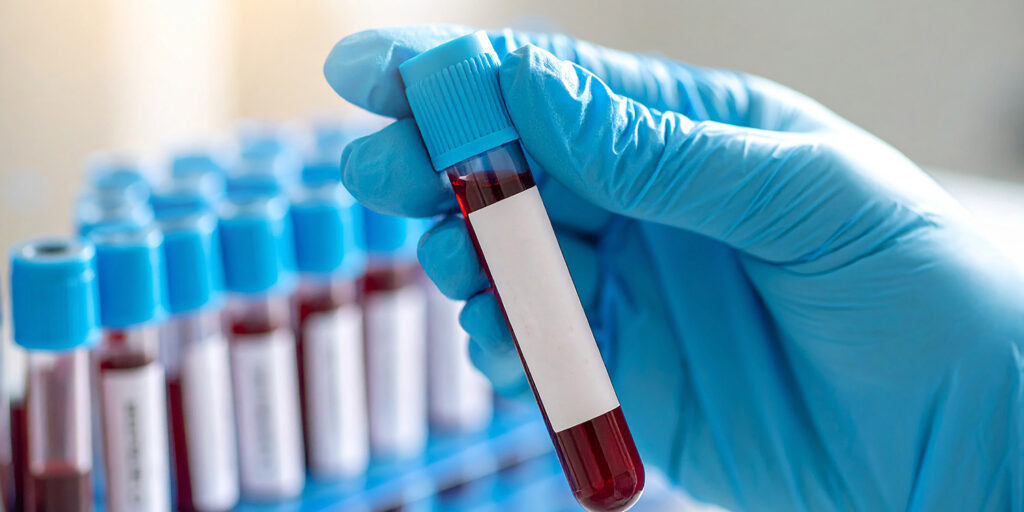 Regular Blood Tests