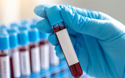 Regular Blood Tests