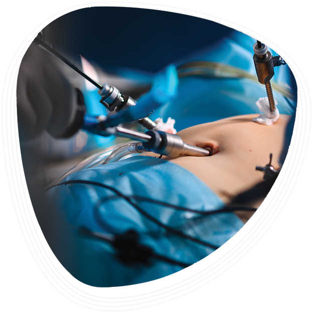 Why Choose Graphic Era Hospital for Hiatal Hernia Surgery