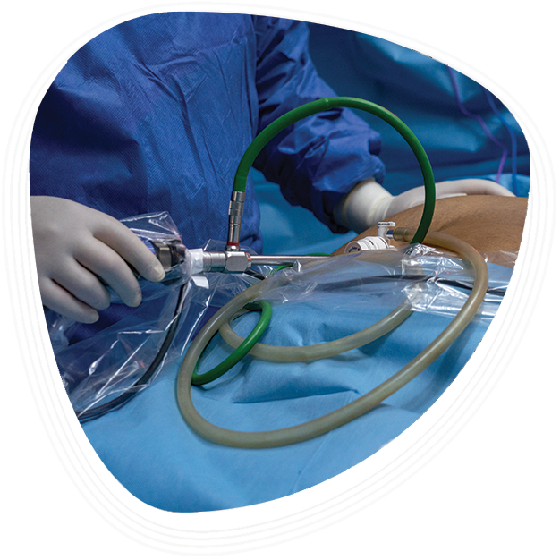 Why Choose Graphic Era Hospital for the Gastrectomy Procedure