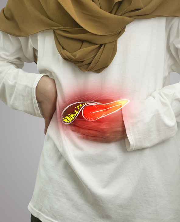 Gallstones (Cholelithiasis) Treatment in Dehradun