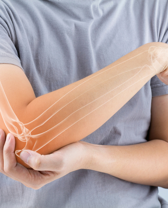 Osteoporosis Treatment in Dehradun