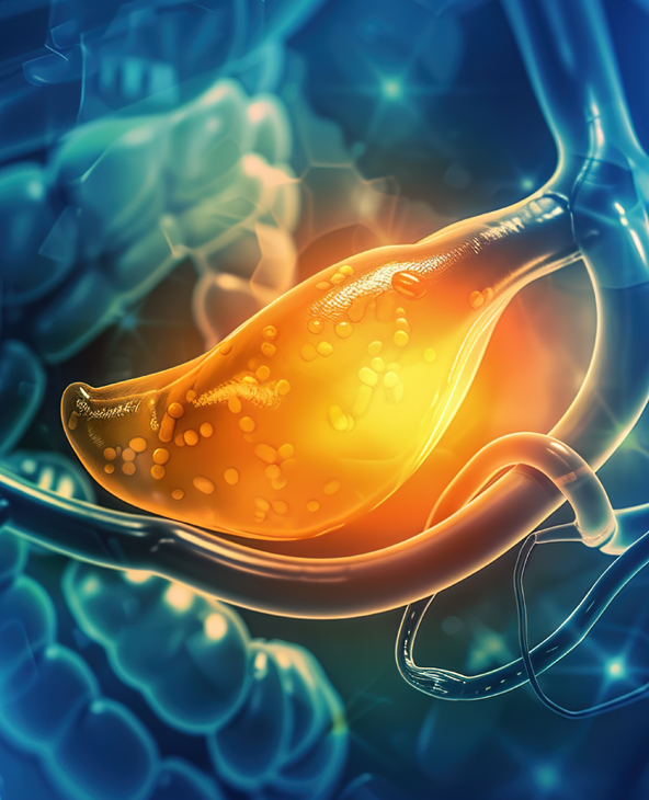 Radical Cholecystectomy in Dehradun
