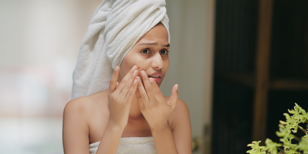Teen Acne: How to Manage it without Damaging the Skin