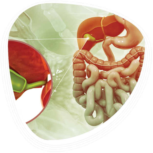 Why Choose Graphic Era Hospital for Gallbladder Stone Treatment