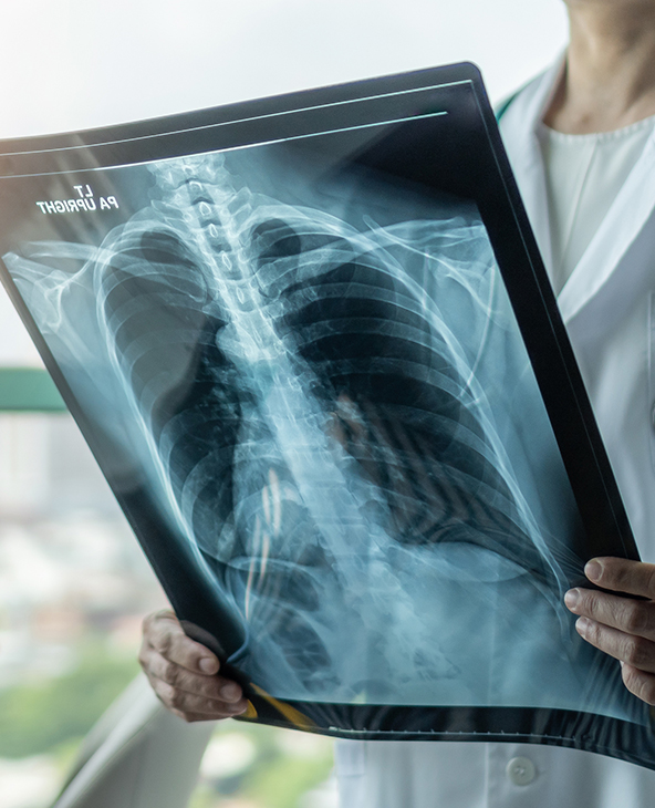 1000 mA X-Ray in Dehradun