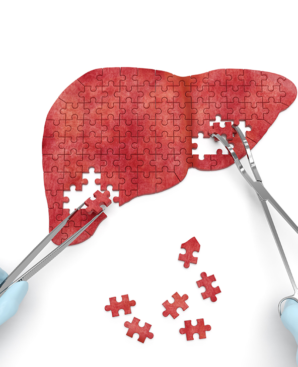 Liver Resection (Hepatectomy) Surgery
