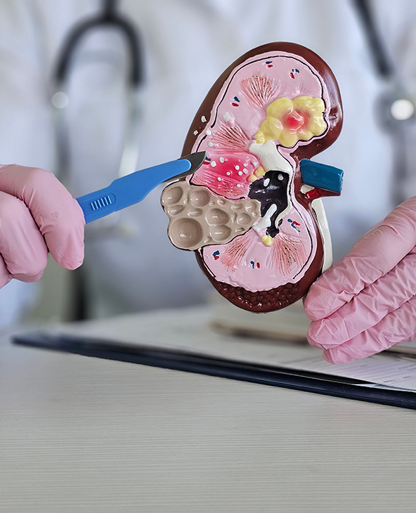 PCNL Surgery (Percutaneous Nephrolithotomy) in Dehradun