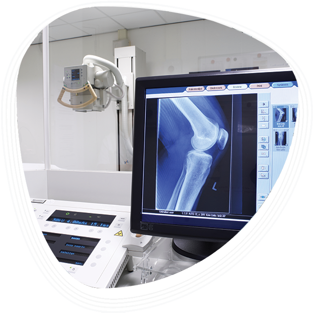 Why Choose Graphic Era Hospital for Advanced X-Ray