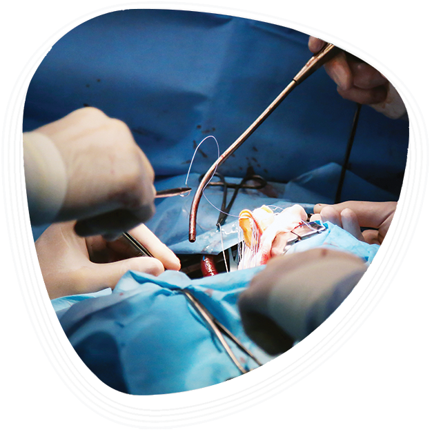 Why Choose Graphic Era Hospital for CABG Surgery in Dehradun