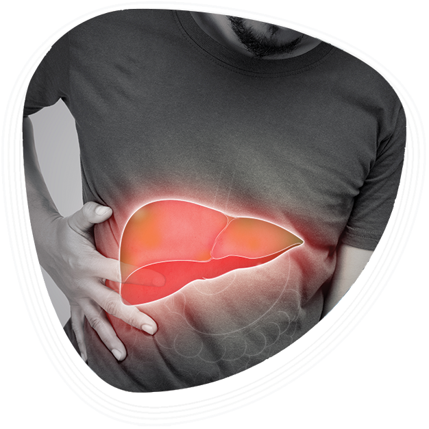 Why Choose Graphic Era Hospital for Fatty Liver Treatment