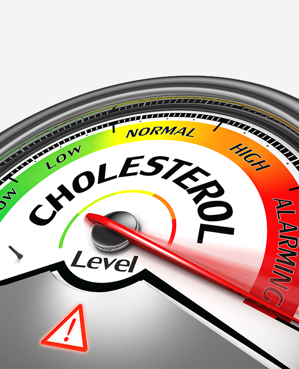 High Cholesterol Treatment in Dehradun