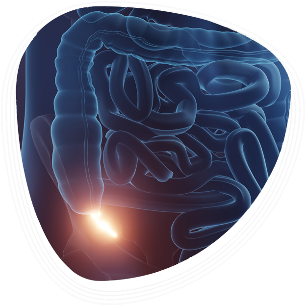 Why Choose Graphic Era Hospital for Appendectomy in Dehradun