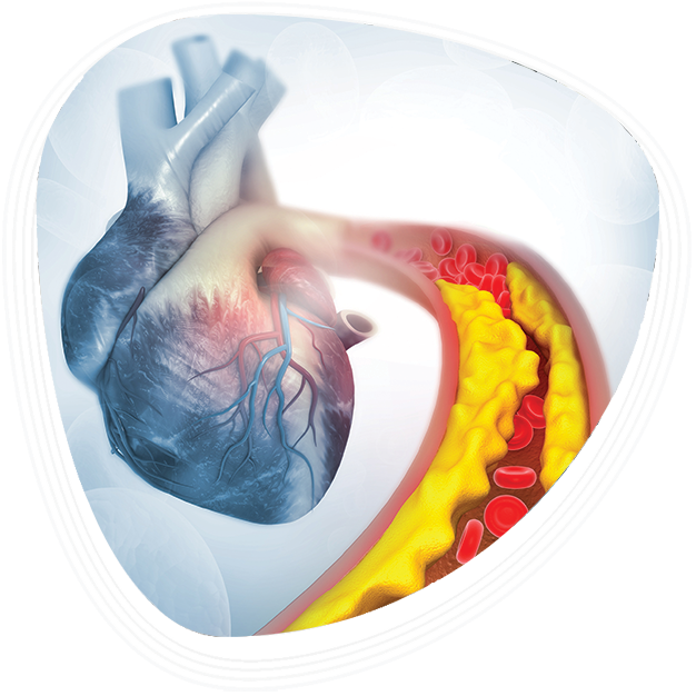 Why Choose Graphic Era Hospital for High Cholesterol Treatment