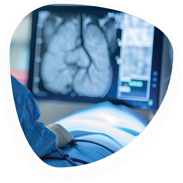 Why Choose Graphic Era Hospital for Angiography in Dehradun