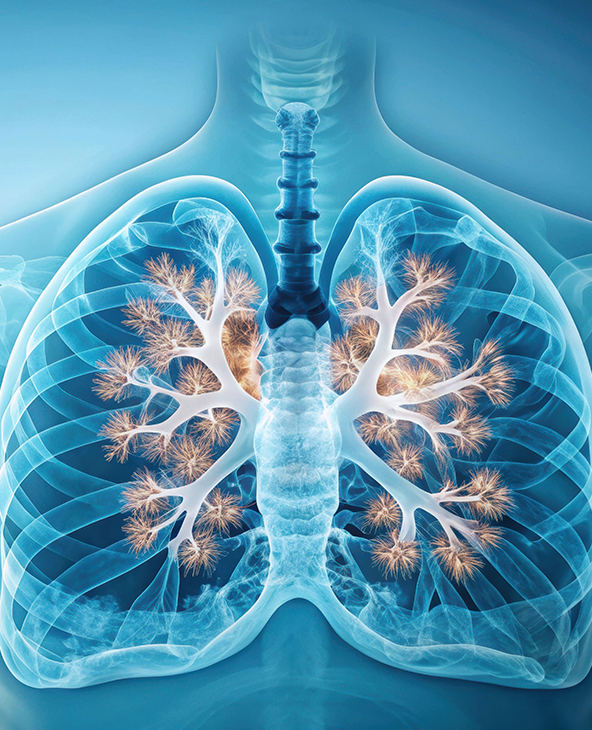 Bronchiolitis Treatment in Dehradun