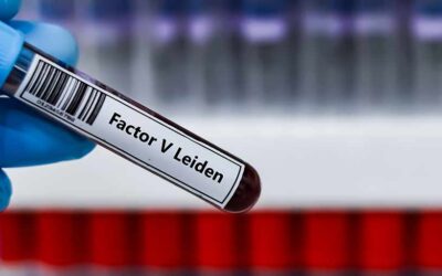 Thrombophilia Profile Test