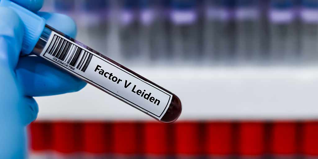 Thrombophilia Screening: Who Needs it and Why it Matters