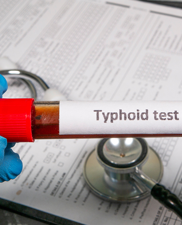 Typhoid Treatment in Dehradun