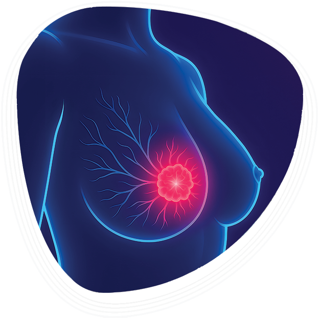 Why Choose Graphic Era Hospital for Mastectomy Surgery