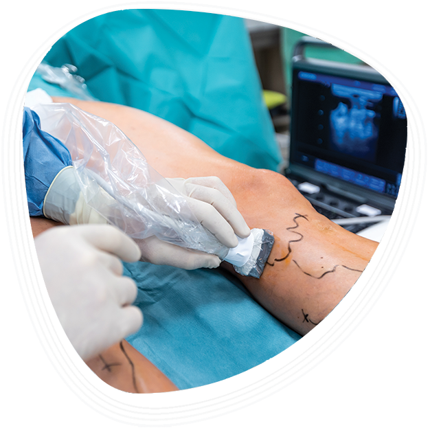 Why Choose Graphic Era Hospital for Vascular Care