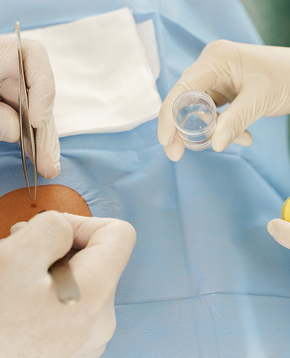 Biopsy in Dehradun