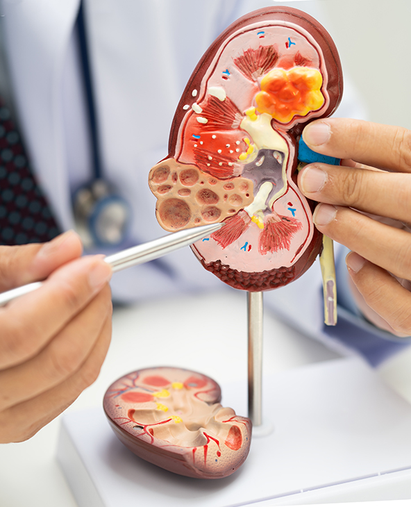 Chronic Kidney Disease (CKD) Treatment in Dehradun
