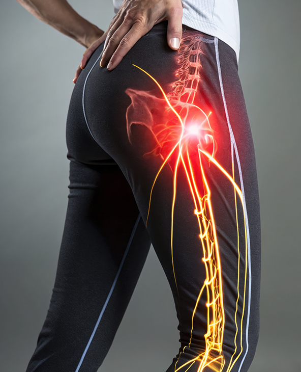 Sciatica Treatment in Dehradun
