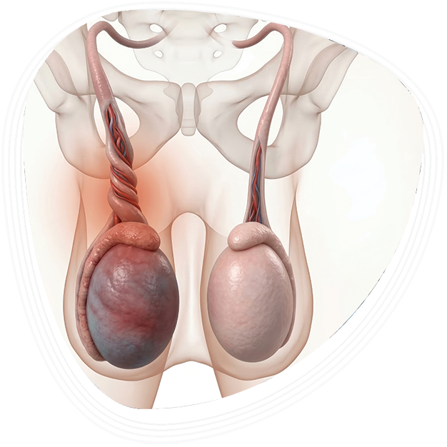 Why Choose Graphic Era Hospital, Dehradun, for Testicular Torsion Treatment