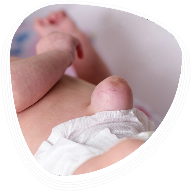 Why Choose Graphic Era Hospital for CDH Treatment in Dehradun