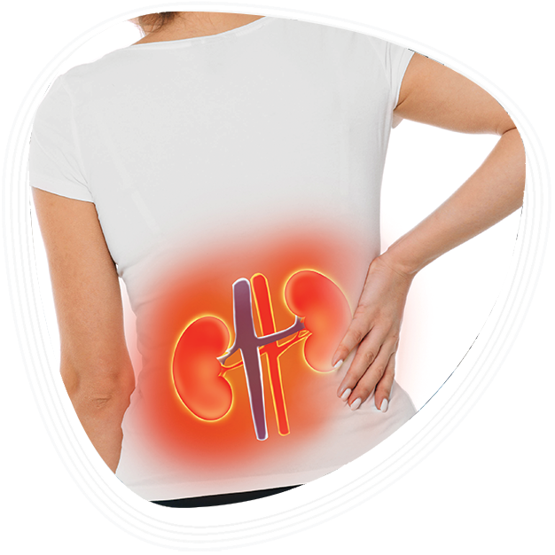Why Choose Graphic Era Hospital for CKD Treatment in Dehradun