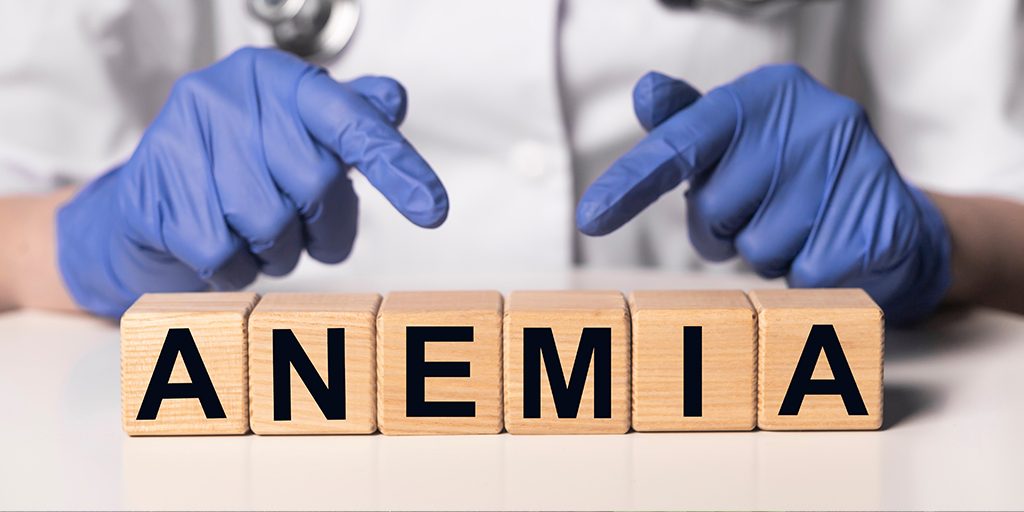 The Ultimate Guide to Iron-Deficiency Anaemia: Causes, Diagnosis, and Treatment