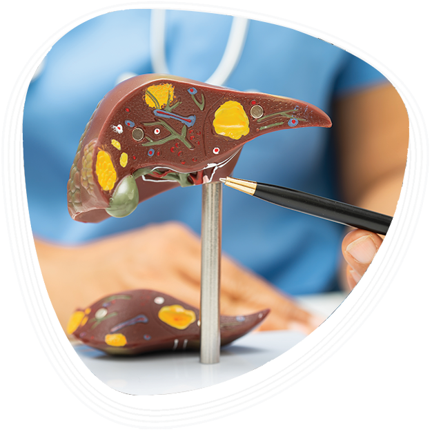 Why Choose Graphic Era Hospital for Enlarged Liver Treatment