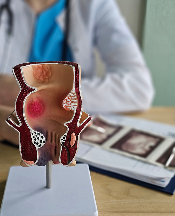 Anal Fissure Surgery in Dehradun